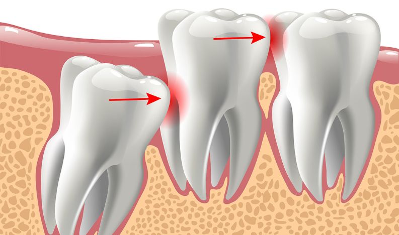 Untitled design (73)